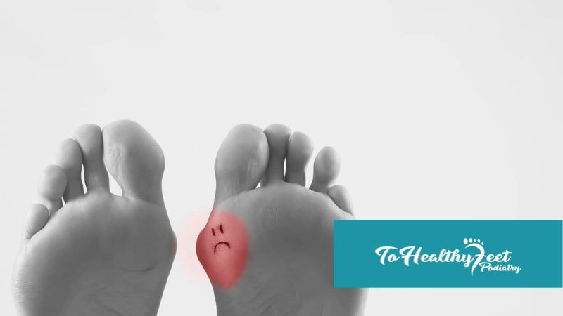 How To Prepare For Your Bunion Surgery